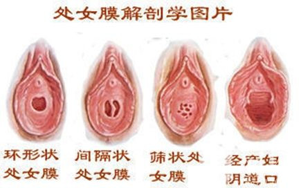 女性生殖器真人放大图图解(6)(点击浏览下一张趣图)