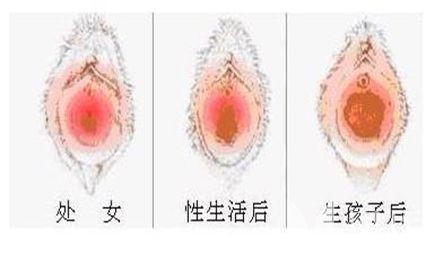 女性生殖器真人放大图图解(7)(点击浏览下一张趣图)