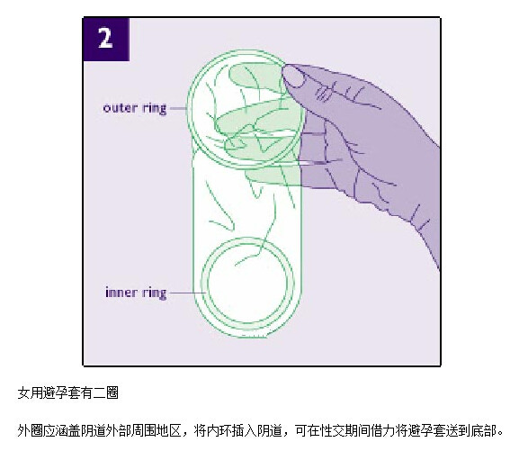 女用避孕套演示动态图(2)(点击浏览下一张趣图)