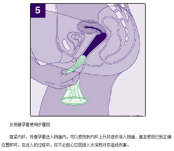 女用避孕套演示动态图(5)(点击浏览下一张趣图)