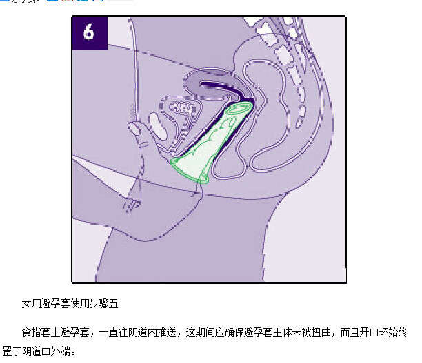 女用避孕套演示动态图(6)(点击浏览下一张趣图)