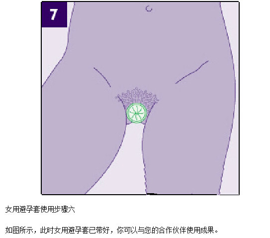 女用避孕套演示动态图(7)(点击浏览下一张趣图)