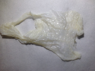 排卵期白带拉丝图片(2)(点击浏览下一张趣图)