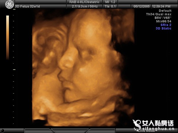 怀孕九个月胎儿图（男女B超图）(2)(点击浏览下一张趣图)