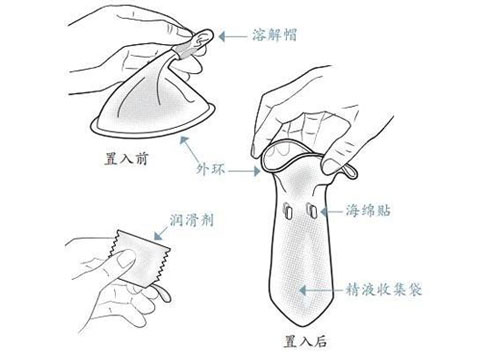 女性避孕套使用方法图解(3)(点击浏览下一张趣图)
