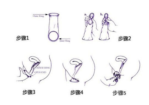女性避孕套使用方法图解(4)(点击浏览下一张趣图)