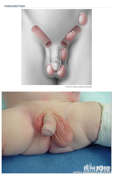 睾丸是什么样子图片：大机机图片大全大图(点击浏览下一张趣图)