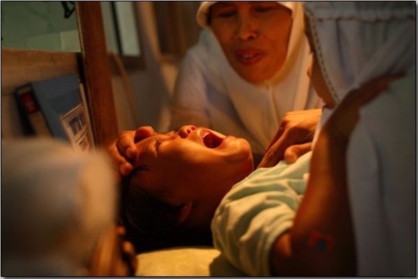 印尼女孩割礼后图片：女性割礼怎么回事图片(5)(点击浏览下一张趣图)