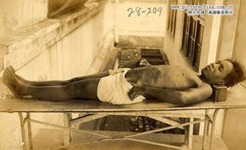 731活人实验图片：731活体解剖图片，731活体解剖不给麻醉(2)(点击浏览下一张趣图)