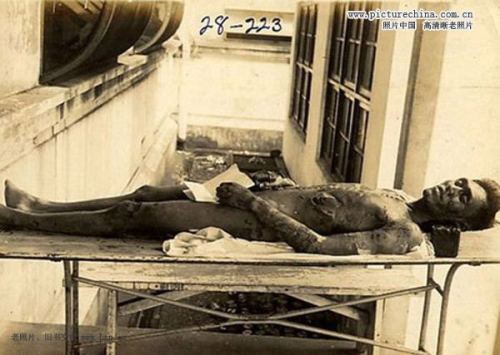 731活人实验图片：731活体解剖图片，731活体解剖不给麻醉(5)(点击浏览下一张趣图)