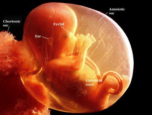 实拍四个月引产胎儿图片，实拍四个月引产胎儿图片(点击浏览下一张趣图)