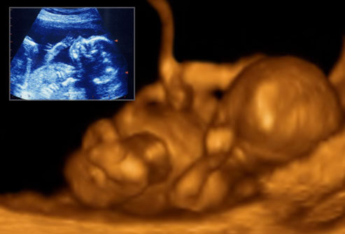 实拍四个月引产胎儿图片，实拍四个月引产胎儿图片(4)(点击浏览下一张趣图)
