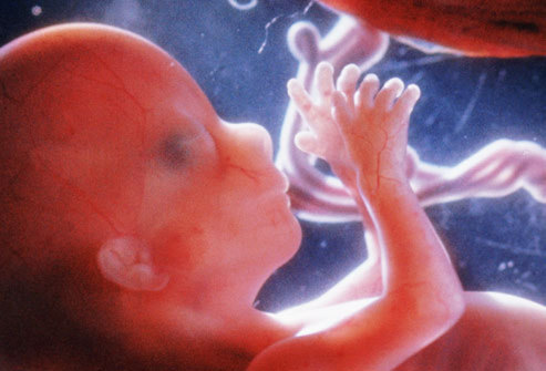 实拍四个月引产胎儿图片，实拍四个月引产胎儿图片(5)(点击浏览下一张趣图)