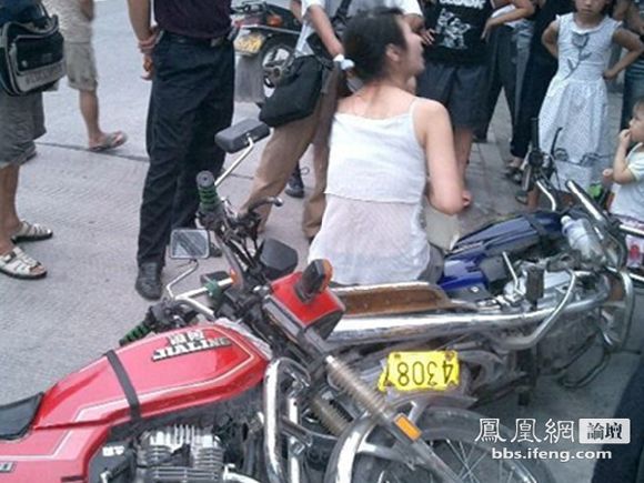 车祸美女腿被劈开：女生腿流血出车祸图片(2)(点击浏览下一张趣图)