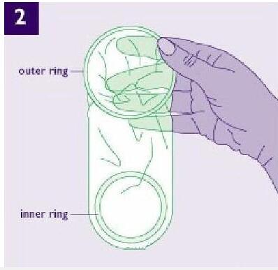 女用避孕套演示大图：安全套长什么样(5)(点击浏览下一张趣图)