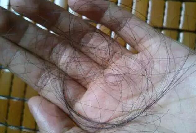 女性掉发原因及治疗，女性脱发吃什么长头发 总是掉头发吃什么好(点击浏览下一张趣图)