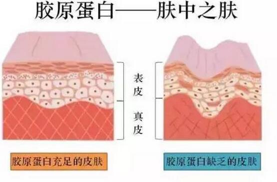 女人脸上长斑的原因：女人为什么容易长斑(2)(点击浏览下一张趣图)