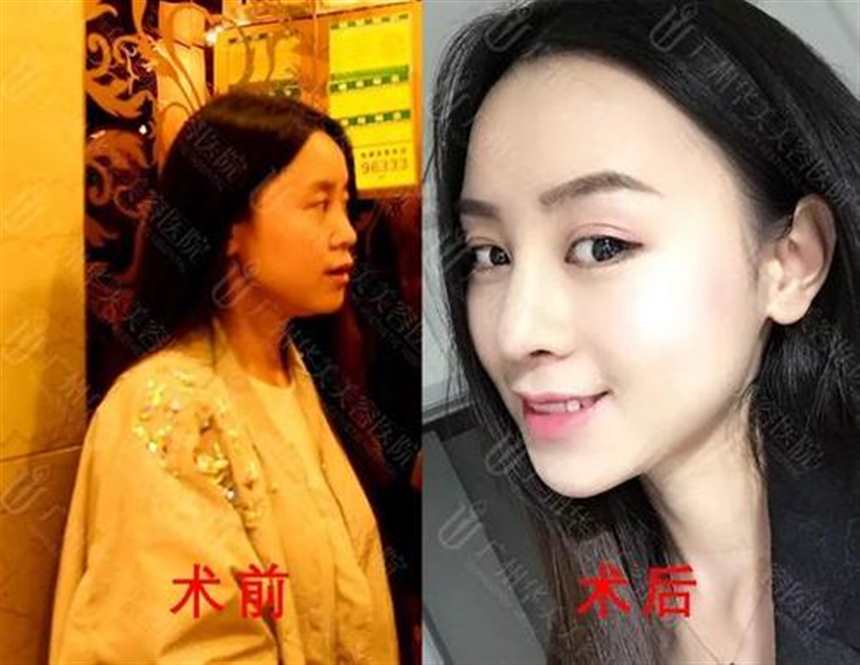 男变女整形医院 在哪可以做？(2)(点击浏览下一张趣图)