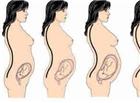 怀孕4个月注意事项