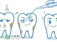 洗牙多少钱一次 洗牙多久洗一次比较好