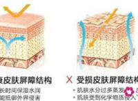 怎么修复角质层薄敏感肌