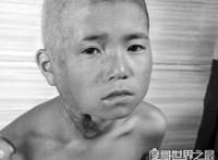 福岛核泄漏后变异女人，生出巨型“幽灵婴儿”(头皮发麻)
