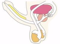 睾丸萎缩怎么办？是什么原因？
