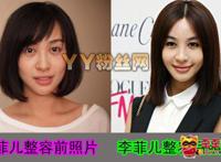 李菲儿整容经历,李菲儿整容前后照片对比