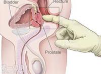 前列腺按摩的方法【图】老司机教你自己按摩前列腺