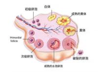 黄体破裂到底有多严重？看完不敢用力爱爱了