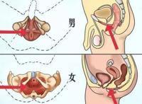 勃起不坚容易疲软怎么办？教你规范提升性能力