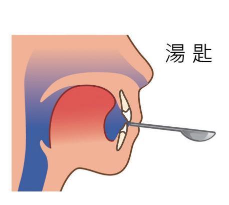 鼻塞怎么快速通气 含温水摆头3分钟