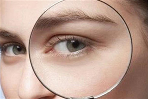 眼部皮肤松弛怎么处理 眼部皮肤松弛是什么原因造成的