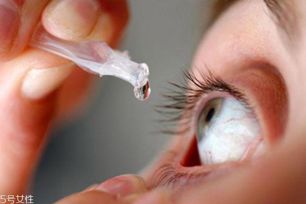 眼结石怎么治疗 日常要注意用眼卫生