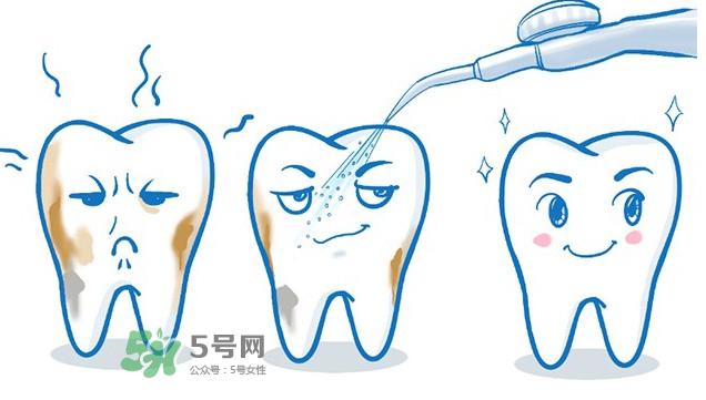 洗牙多少钱一次 洗牙多久洗一次比较好