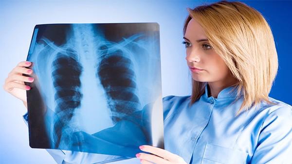 肺癌手术后能活多久？肺癌的主要症状是什么