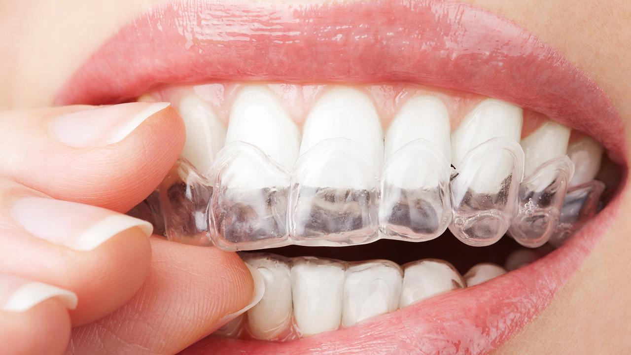 牙疼怎么办立刻止痛 6个简单方法可以快速止牙痛