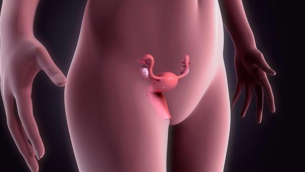 子宫内膜癌的症状是什么？了解内膜癌的三连症