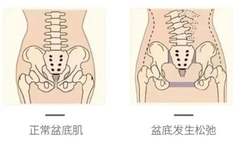 被女朋友夹的很紧是什么体验,是不是所有女孩都会夹