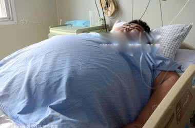 中国最胖人孙亮是谁 最胖的时候600斤后来去世了