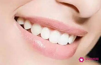 牙齿美容的方法有哪些
