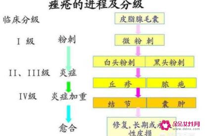 脸颊两边反复长痘痘是什么原因引起的