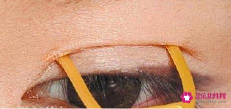 双眼皮胶水使用方法及问题