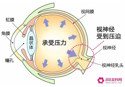 眼压高是什么原因造成的