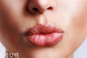 唇部去角质多久一次 唇部肌肤改善方法