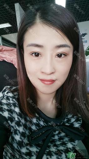 埋线双眼皮能保持多久?埋线双眼皮是永久吗
