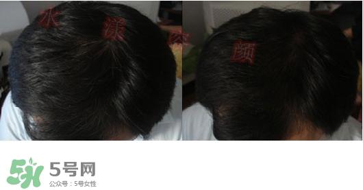 资生堂不老林洗发水怎么样?资生堂不老林洗发水能长头发吗