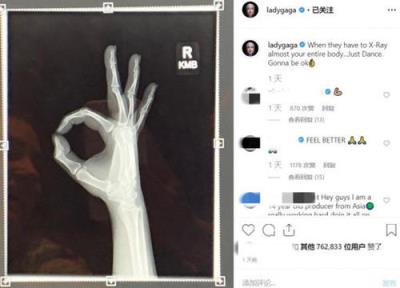 ladygaga宣布分手，于社交平台宣布自己单身！