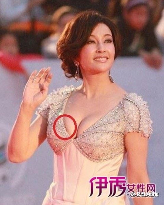 60岁刘晓庆侧脸无纹靠卵巢保养?(组图)