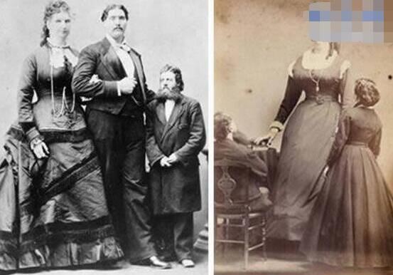 世界上最长的阴道女人，苏格兰安娜·斯瓦(长达2.3米)